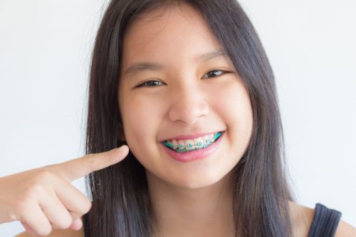 Girl pointing to braces on her teeth