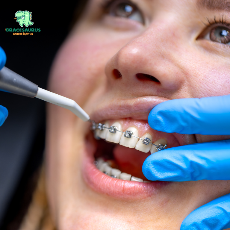 Self-Ligating Damon Braces vs. Traditional Braces: Which Smile Wins?