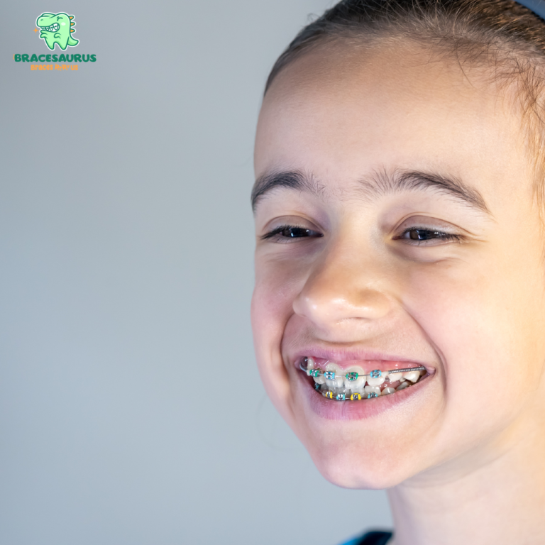 Singapore Braces Expert Explains: Metal vs. Ceramic vs. Invisible Braces