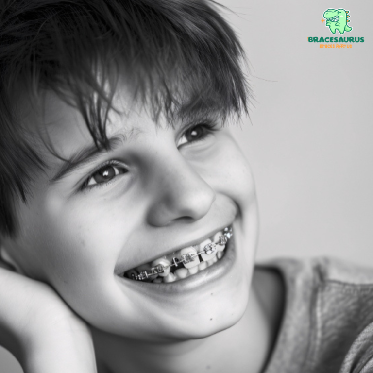 5 Things to Know Before Getting Teeth Braces in Singapore.