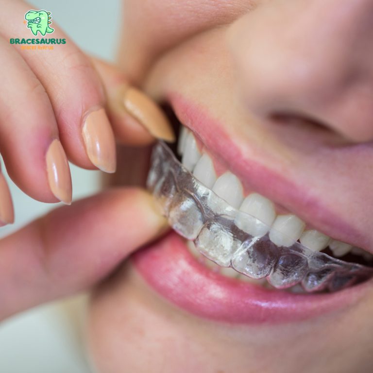 Can Clear Aligners Fix My Teeth? Here’s What You Should Know