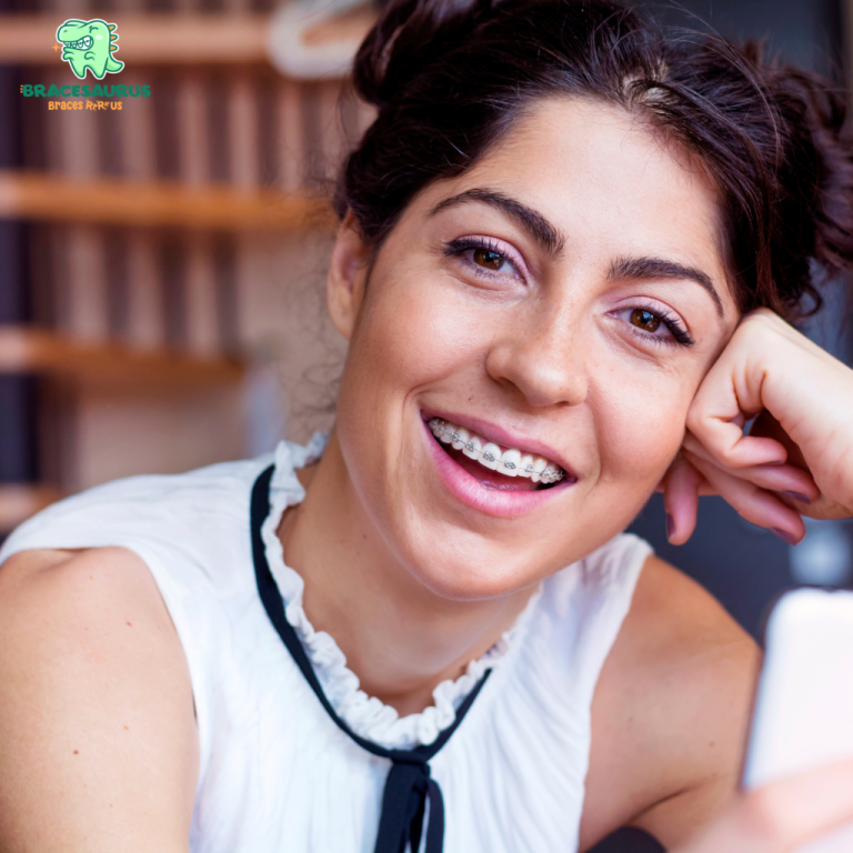 Self Ligating Braces Singapore: What Makes Them Different from Traditional Braces?