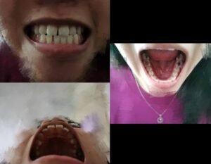 Photos of teeth from different views