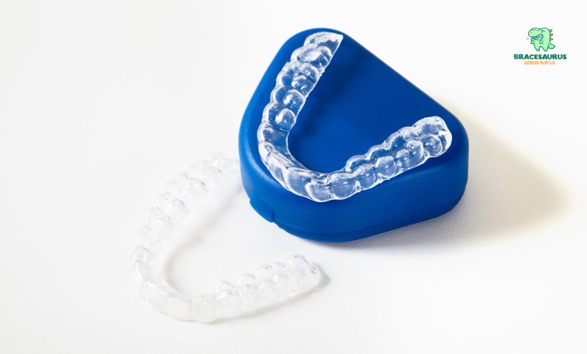 clear aligners in Singapore