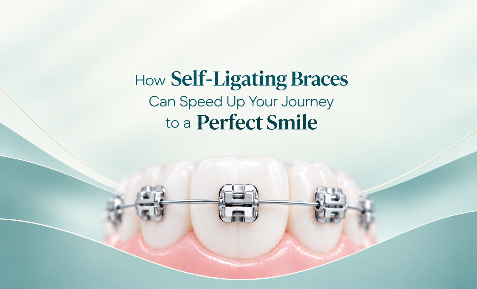 aligners treatment in singapore
