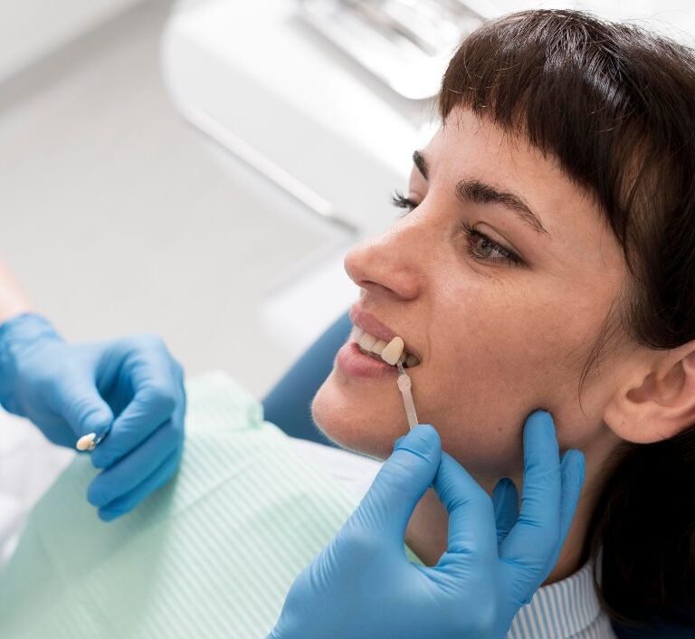 Clear Aligner Braces