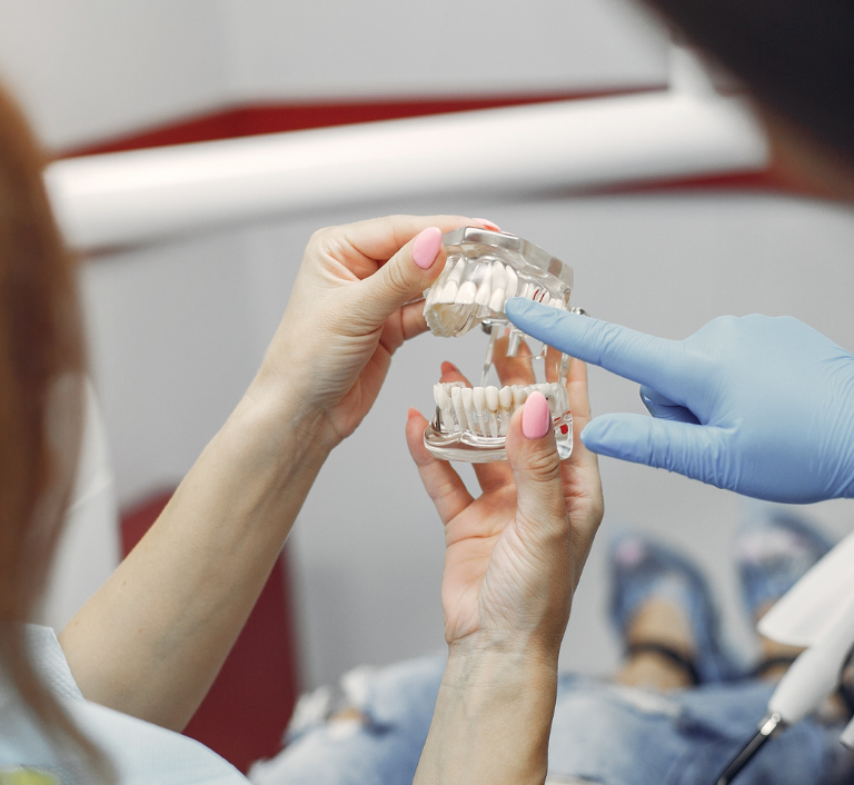 clear aligners