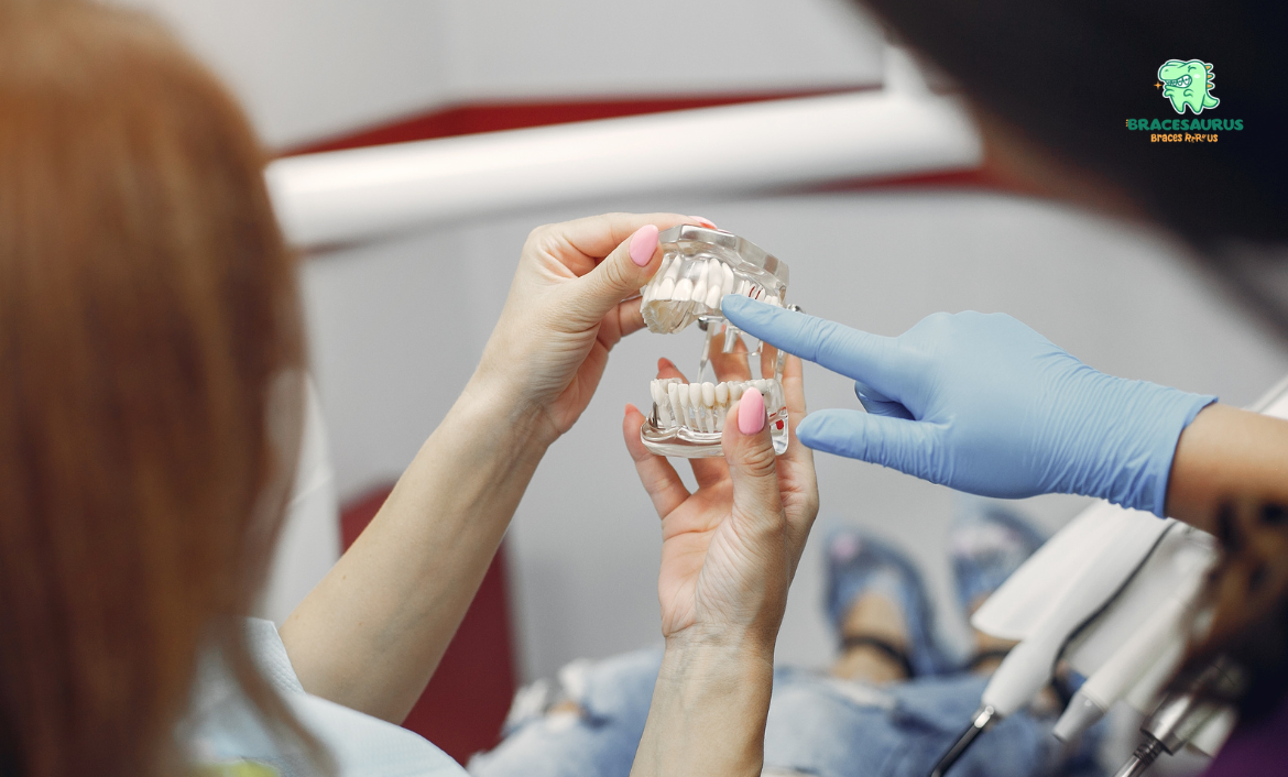 clear aligners